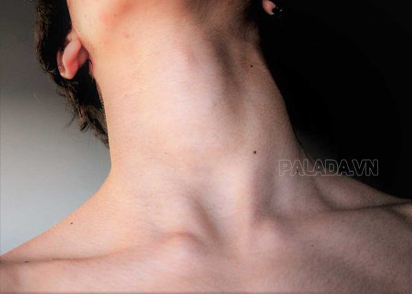 Xương quai xanh là gì? Tiêu chí đánh giá xương quai xanh đẹp