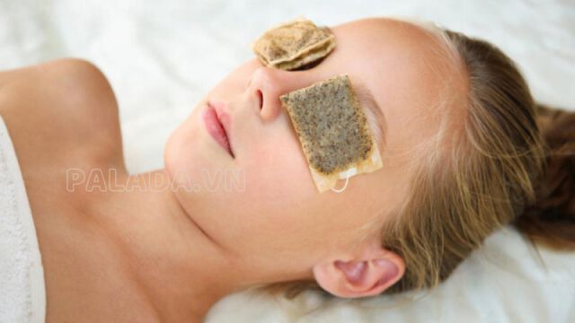 Sử dụng túi trà ấm đắp lên mắt giúp giảm sưng hiệu quả
